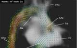 MR技术新方法首次以4D方式显示胎儿心脏