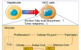 揭示肝癌脂代谢异常的关键分子机制，为靶向治疗提供新的科学依据
