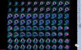 “心驰神往，深入人心”记江苏省人民医院D-SPECT临床应用初体验